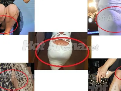 ТОП 5 на целулитените певици (УНИКАЛНИ СНИМКИ)