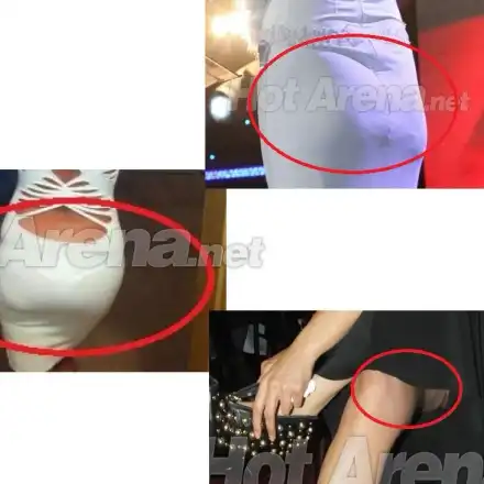 ТОП 5 на целулитените певици (УНИКАЛНИ СНИМКИ)