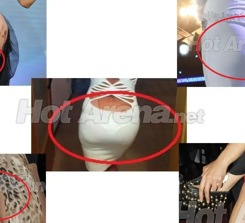 ТОП 5 на целулитените певици (УНИКАЛНИ СНИМКИ)