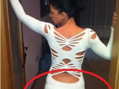 ТОП 5 на целулитените певици (УНИКАЛНИ СНИМКИ)