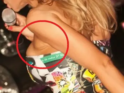 Виж на кои певици им се РАЗКАПА силиконът! (КОФТИ СНИМКИ)