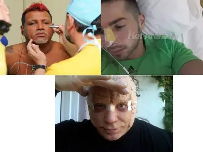 ШАНТАВО! Кои известни БГ ПЕВЦИ имат пластични операции?