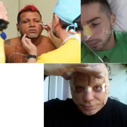 ШАНТАВО! Кои известни БГ ПЕВЦИ имат пластични операции?