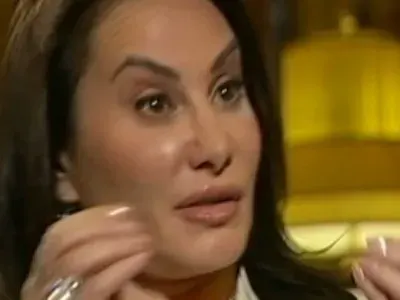 Най-неуспешните пластични операции у нас за 2012 (СНИМКИ)