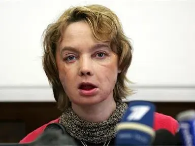 Вижте жената с чуждо лице (СНИМКИ)