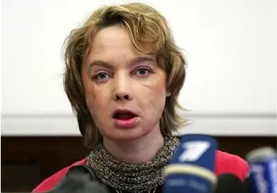 Вижте жената с чуждо лице (СНИМКИ)