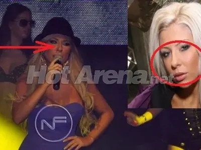 КЛЪЦНИ-СРЕЖИ! Андреа остана без нос? (СНИМКИ)