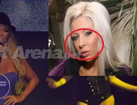 КЛЪЦНИ-СРЕЖИ! Андреа остана без нос? (СНИМКИ)