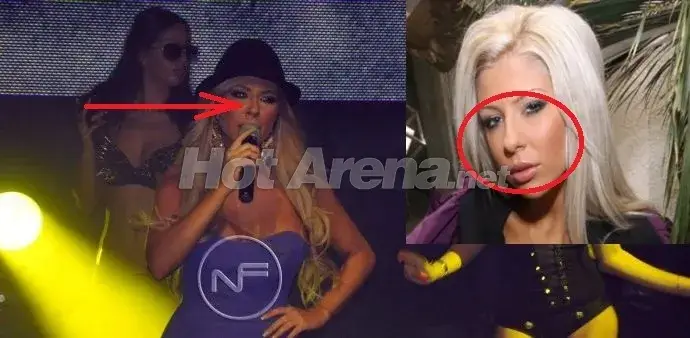 КЛЪЦНИ-СРЕЖИ! Андреа остана без нос? (СНИМКИ)