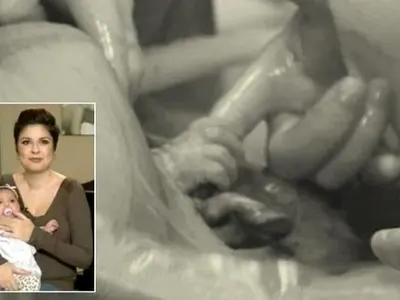 Уникално! Бебе излиза от корема на майка си и хваща ръката на лекаря (ВИДЕО)