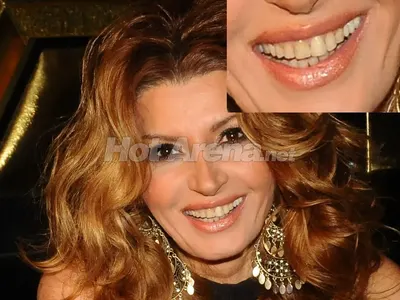 Класация! Тези фолк певици ще ви уплашат, ако се усмихнат (СНИМКИ)