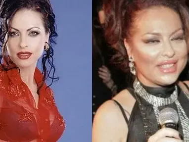 Кои фолк звезди загубиха битката с килограмите (СНИМКИ преди и сега)