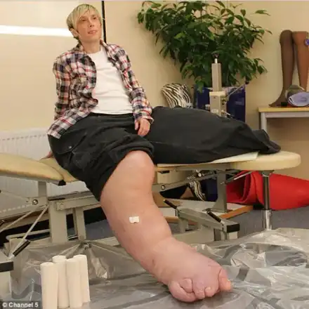 Вижте жената с най-големи крака в света