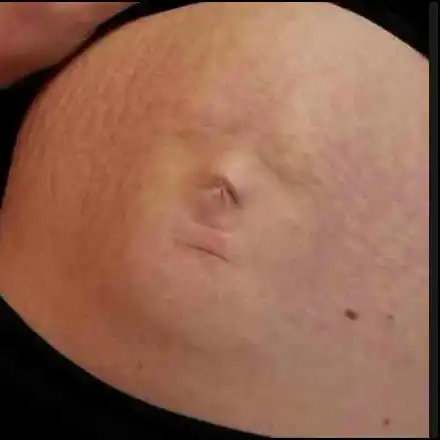 Бебе се показа на корема на майка си (СНИМКИ)