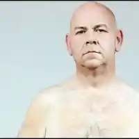 Отслабнал шишко се спъва в кожата си (СНИМКИ)