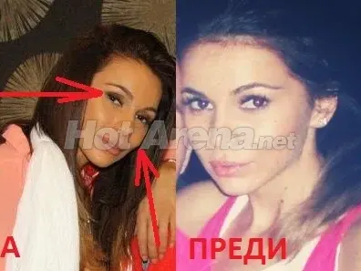 Истината за подуването на Алисия! (СНИМКИ)