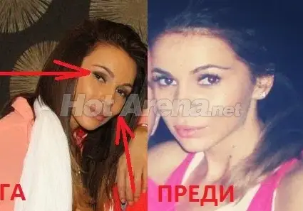 Истината за подуването на Алисия! (СНИМКИ)