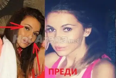 Истината за подуването на Алисия! (СНИМКИ)