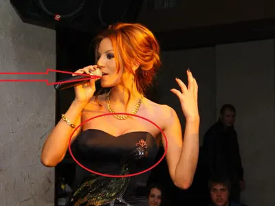 Плачете, фенове! Емилия маха силикона, става натурална! (СНИМКИ)