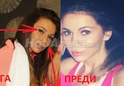 Истината за подуването на Алисия! (СНИМКИ)