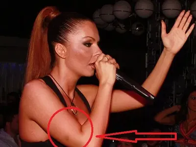 Галена със синки по лицето след скандала с любовника? (ФОТО)