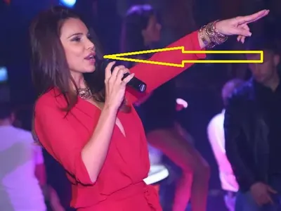 Колко корекции има Алисия на устата си? (СНИМКИ)