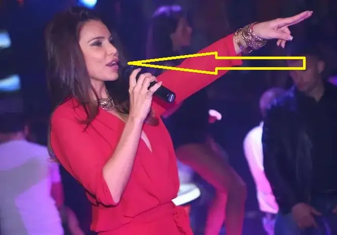 Колко корекции има Алисия на устата си? (СНИМКИ)