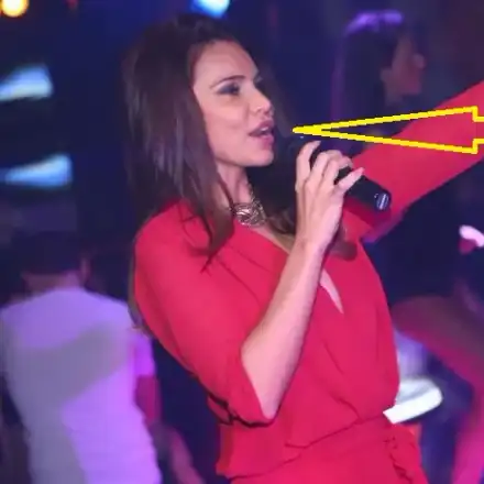 Колко корекции има Алисия на устата си? (СНИМКИ)