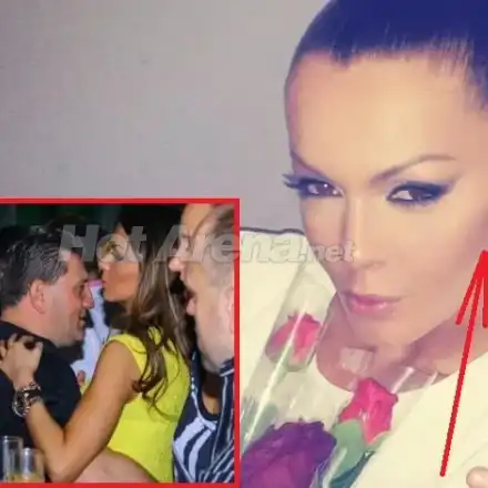 Галена със синки по лицето след скандала с любовника? (ФОТО)