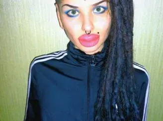 Нашите певици пасти да ядат! Вижте момичето с най-голямата силиконова уста (СНИМКИ)