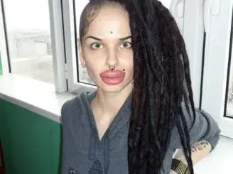 Нашите певици пасти да ядат! Вижте момичето с най-голямата силиконова уста (СНИМКИ)