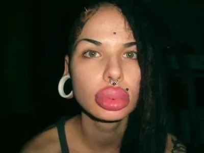 Нашите певици пасти да ядат! Вижте момичето с най-голямата силиконова уста (СНИМКИ)