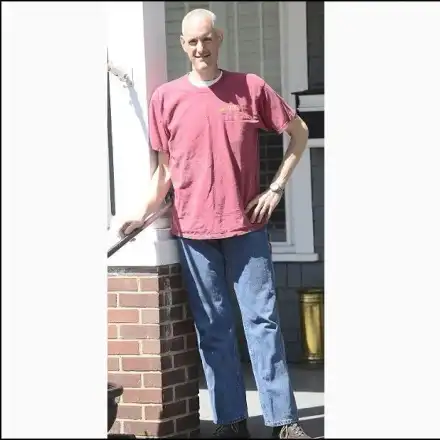 Мъж свали 136 килограма, страх го е от храната