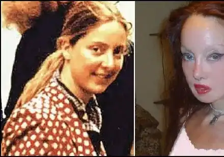 Британка си направи 51 операции, за да заприлича на Нефертити (СНИМКИ)