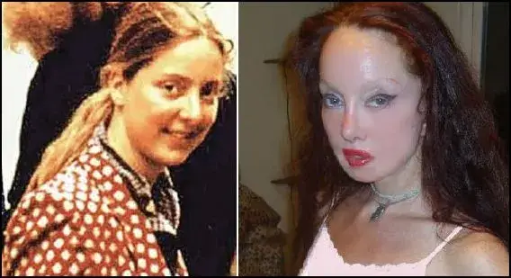 Британка си направи 51 операции, за да заприлича на Нефертити (СНИМКИ)