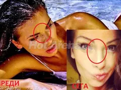 Аксиния си оперира лицето! (Снимки ПРЕДИ и СЕГА)