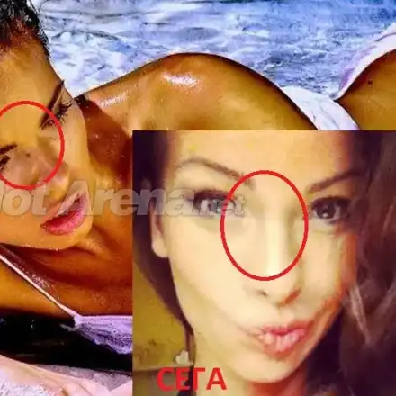 Аксиния си оперира лицето! (Снимки ПРЕДИ и СЕГА)