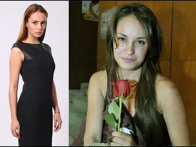 Каква драстична промяна! Вижте Радина ПРЕДИ 5 години и днес (СНИМКИ)