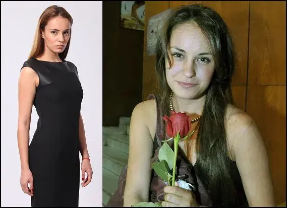 Каква драстична промяна! Вижте Радина ПРЕДИ 5 години и днес (СНИМКИ)