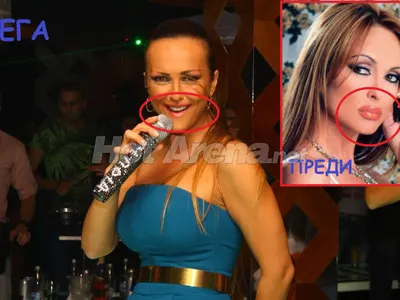 Защо Глория си махна силикона? (СНИМКИ СЛЕД ОПЕРАЦИЯТА)