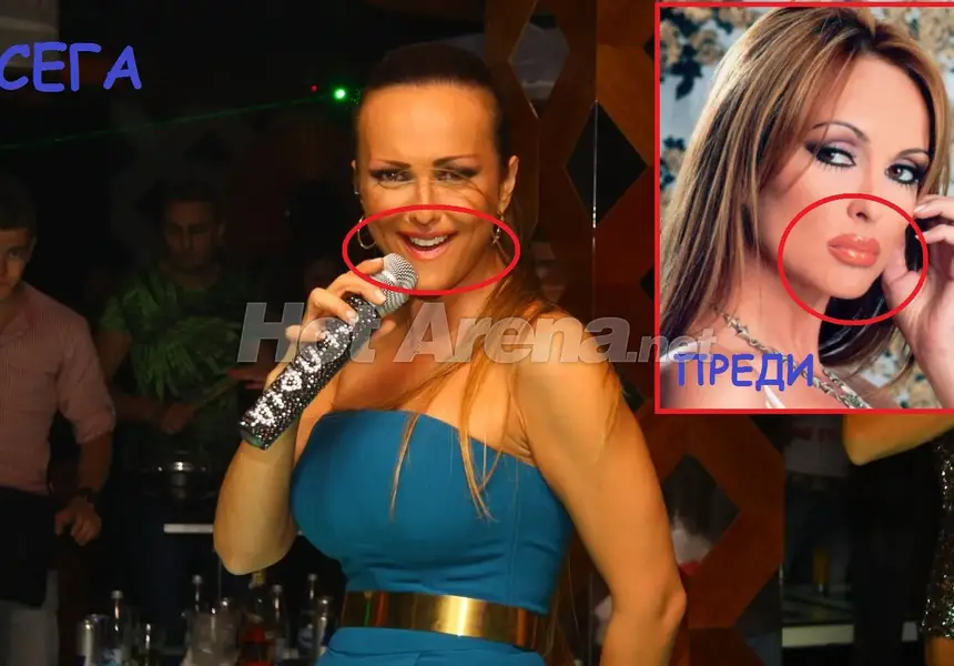 Защо Глория си махна силикона? (СНИМКИ СЛЕД ОПЕРАЦИЯТА)