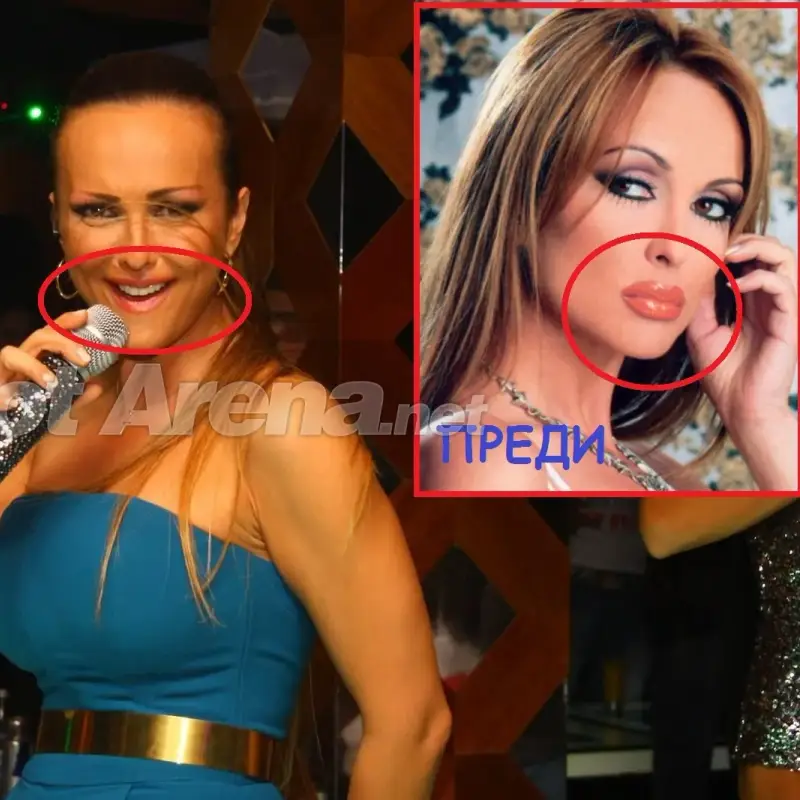 Защо Глория си махна силикона? (СНИМКИ СЛЕД ОПЕРАЦИЯТА)