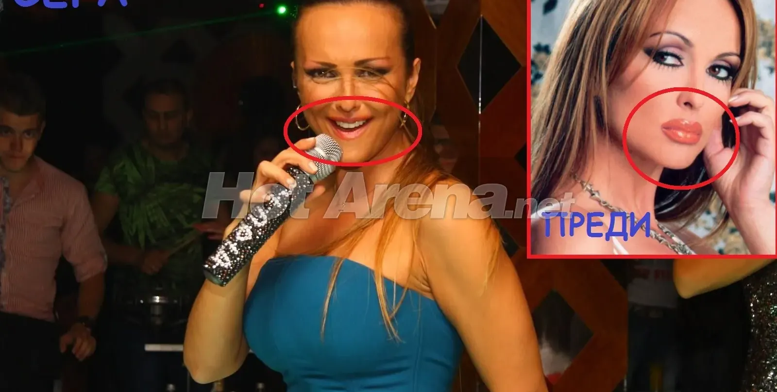 Защо Глория си махна силикона? (СНИМКИ СЛЕД ОПЕРАЦИЯТА)