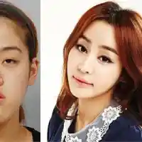 Луда работа! Момичета си трошат челюстите за хубост (Снимки)