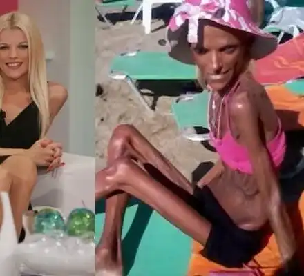 Красавица се превърна в скелет (Снимки)