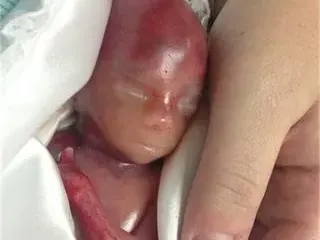 Тези СНИМКИ на бебе родено в 19-та седмица ТРОГНАХА МИЛИОНИ