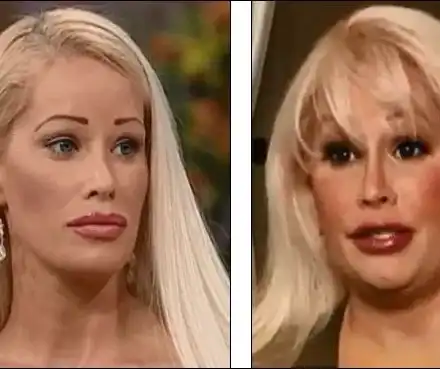 Американка постави рекорд с 59 пластични операции