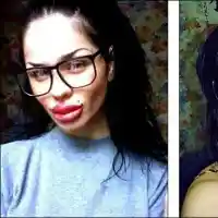 Вижте момичето с най-големите устни в света преди операциите