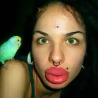 Вижте момичето с най-големите устни в света преди операциите