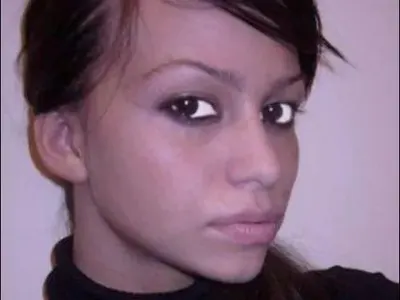 Вижте Звезделина преди операциите (СНИМКИ)